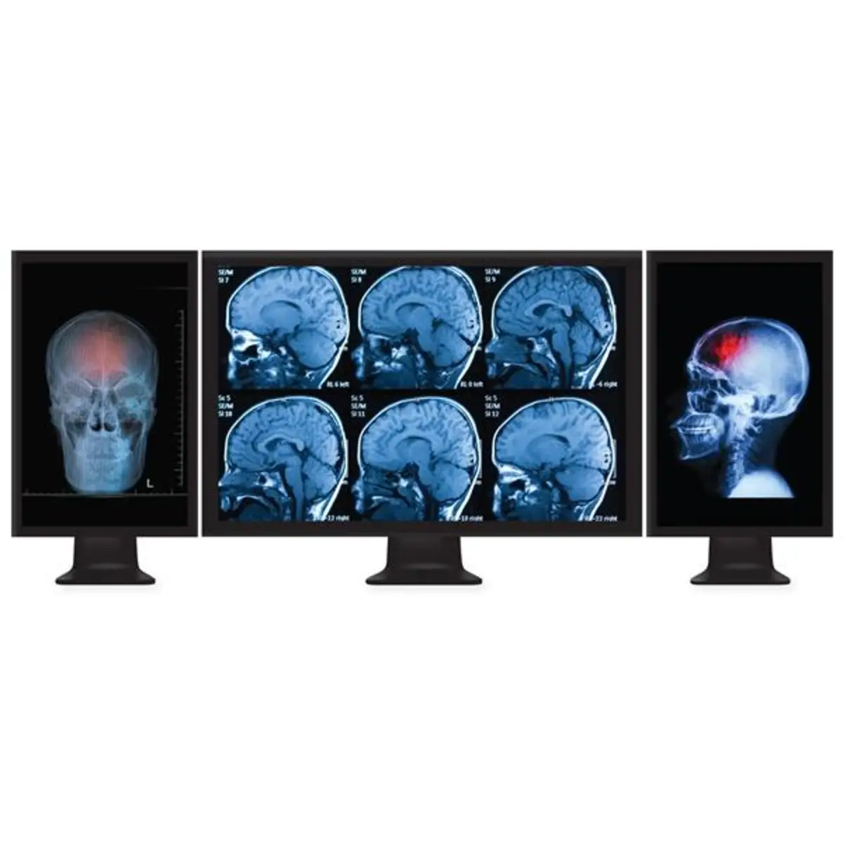 StarTech Multi Stream Transport Hub DisplayPort 3 Ports black