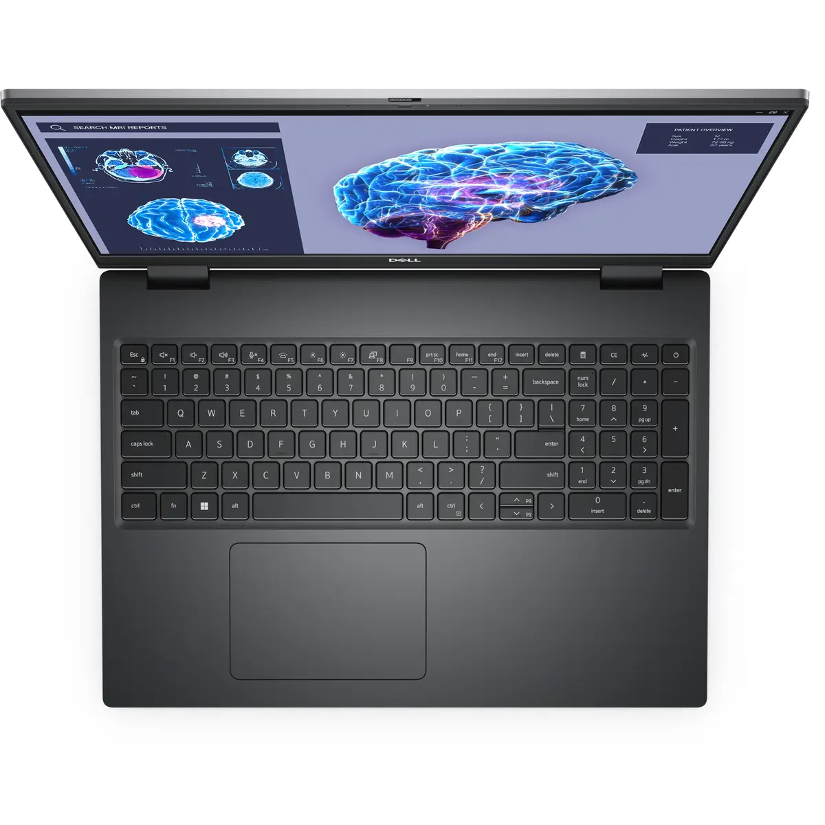 Precision 7680 i7-13850HX 32GB 1TB DDR5 40,64cm W11P